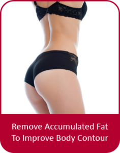 liposuction-fat-removal